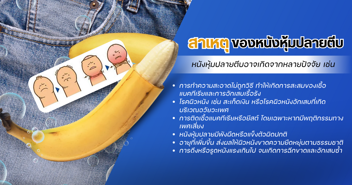 สาเหตุของหนังหุ้มปลายตีบ