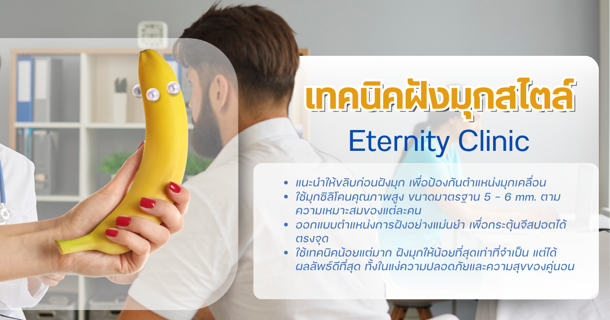 เทคนิคฝังมุก