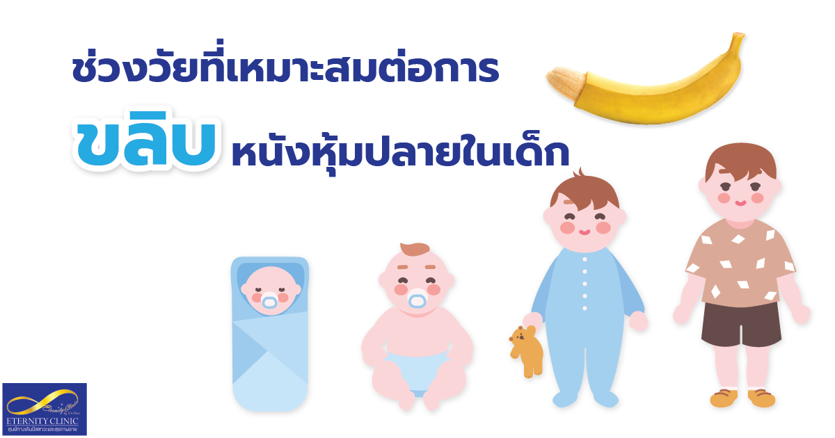 The right age for circumcision - eternityclinicdoctorbeer ช่วยวัยที่เหมาะสมต่อการขลิบ