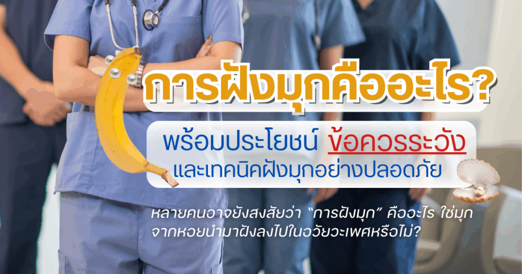 การฝังมุก