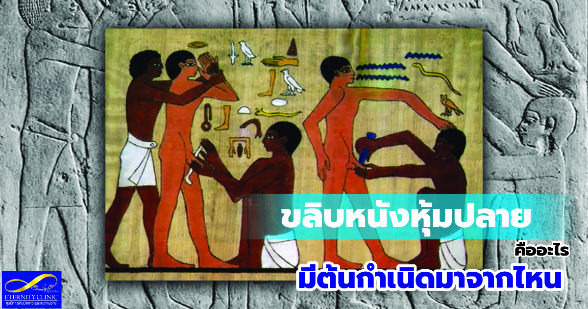 Where did it originate - eternityclinicdoctorbeer ต้นกำเนิดการขลิบ