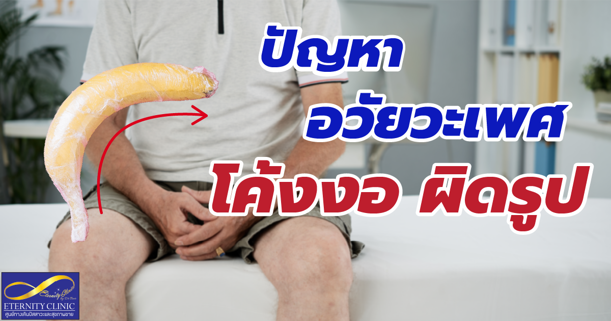 Curved, deformed penis - eternityclinicdoctorbeer ปัญหาที่เกิด