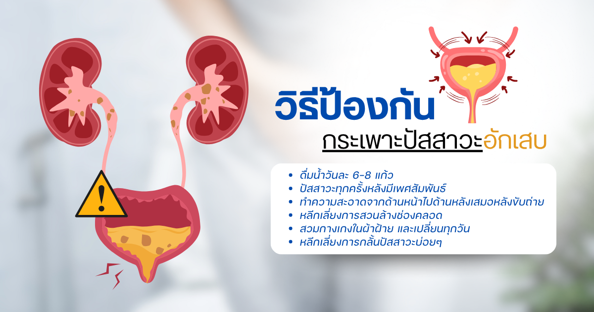 วิธีป้องกันกระเพาะปัสสาวะอักเสบ