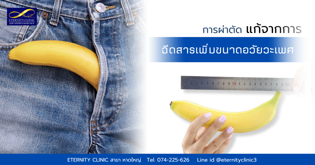 Treat the genitals - eternityclinicdoctorbeer เพิ่มขนาดน้องชาย