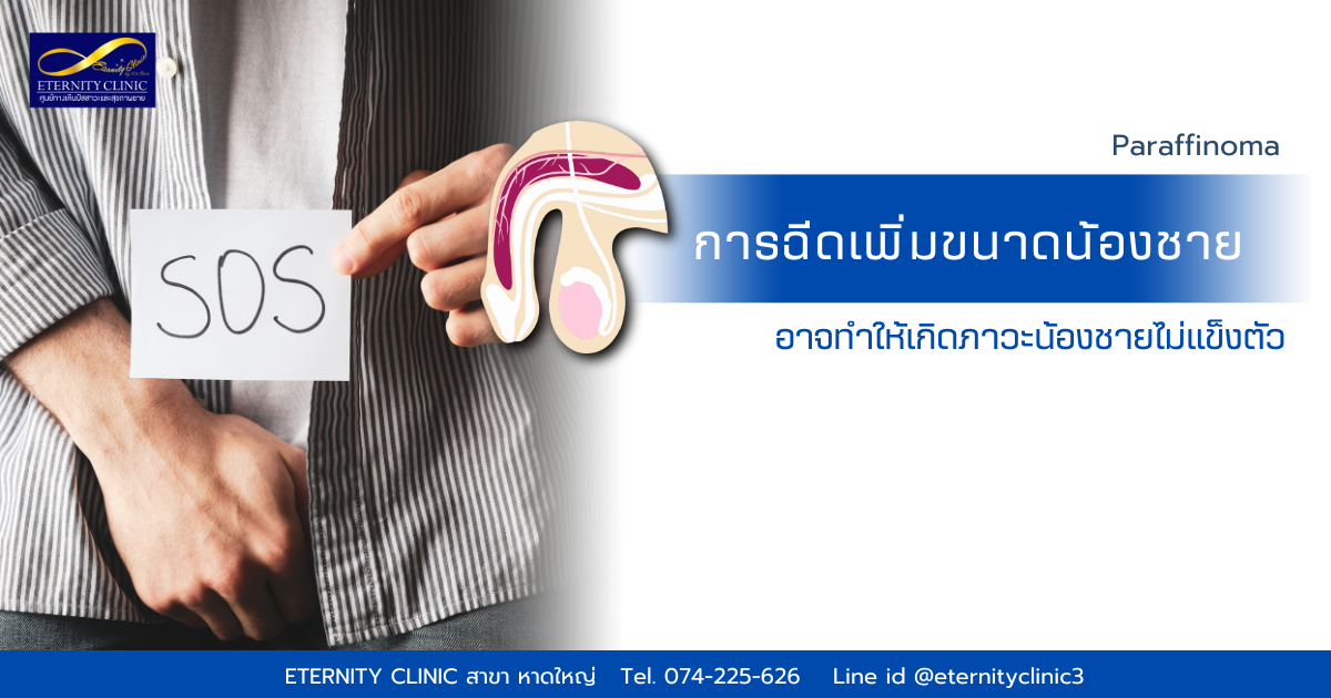 การฉีดเพิ่มขนาดน้องชาย