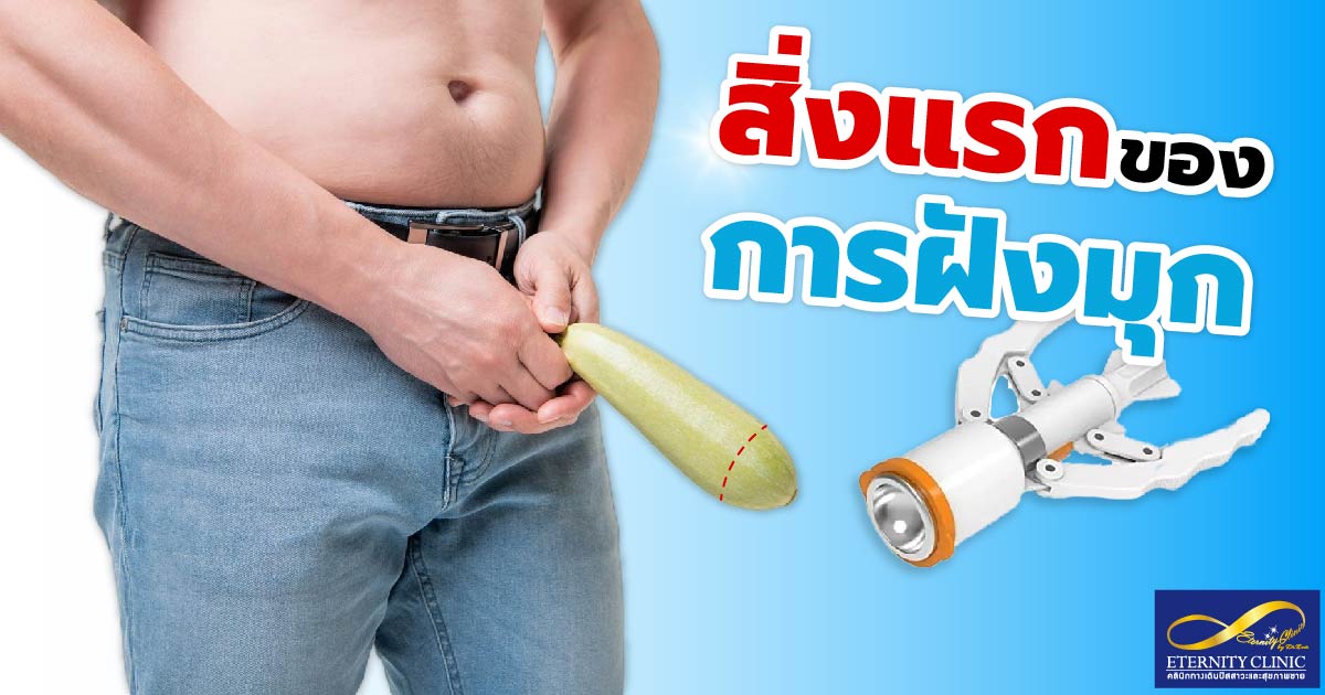The first thing about implanting pearls-01 - eternityclinicdoctorbeer สิ่งแรกก่อนทำ