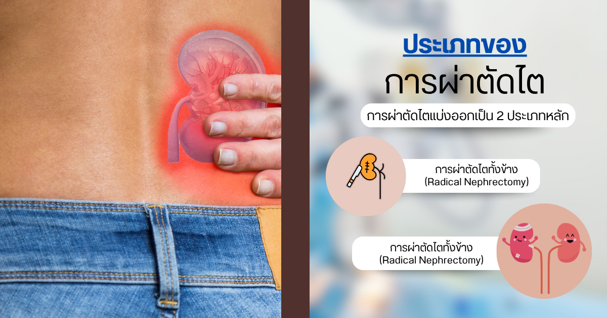ประเภทของการผ่าตัดไต