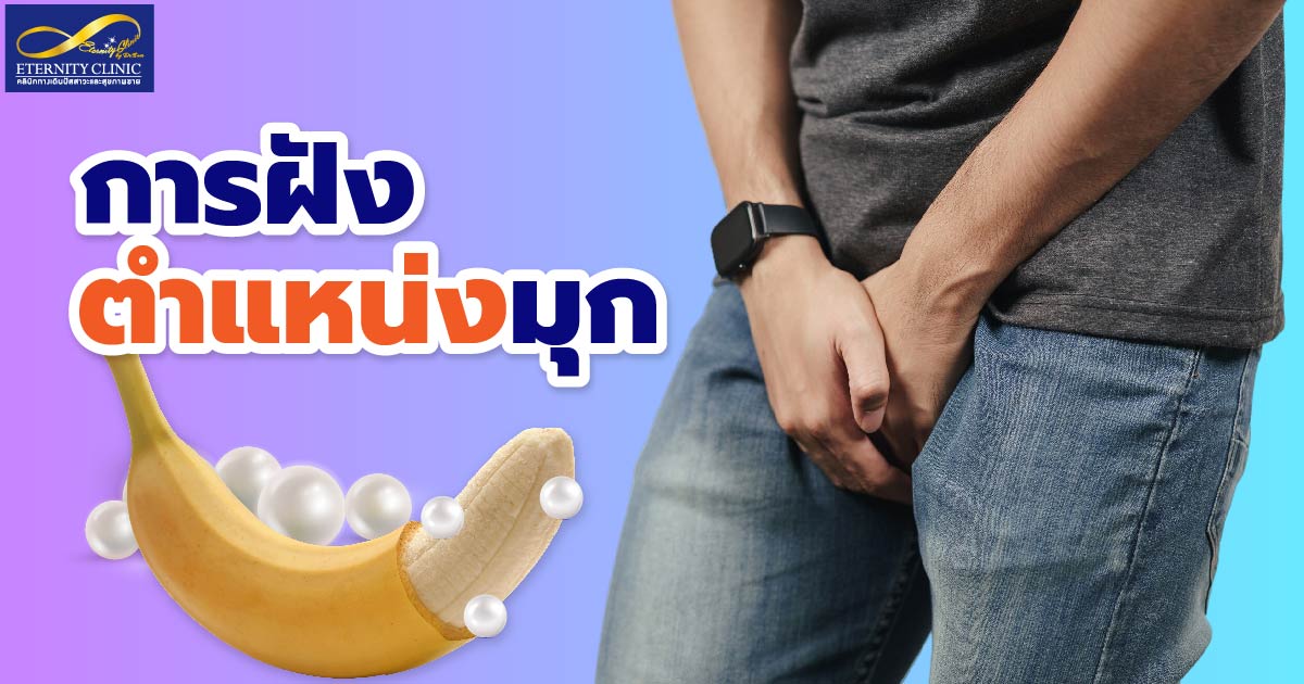 pearl placement - eternityclinicdoctorbeer ตำแหน่ง
