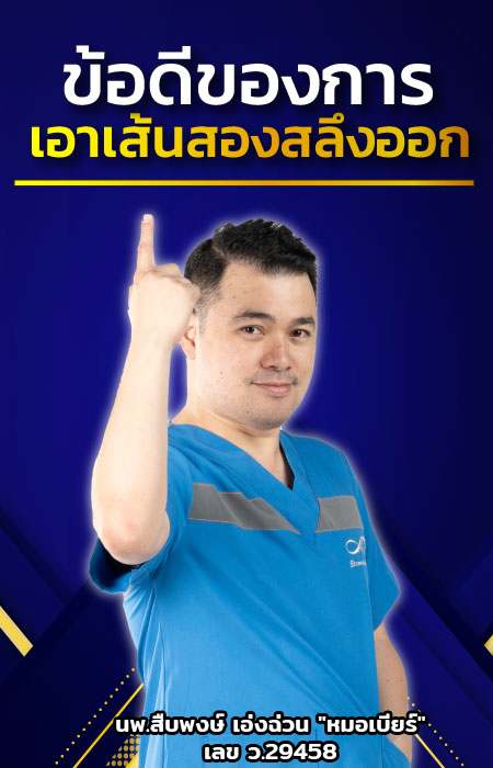 ข้อดี เส้นสองสลึง