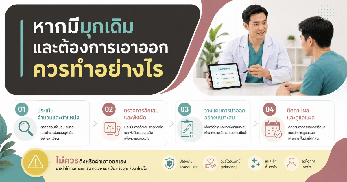หากมีมุกเดิมและต้องการเอาออก ควรทำอย่างไร