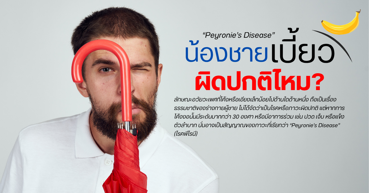 ภาวะอวัยวะเพศชายโค้งงอ
