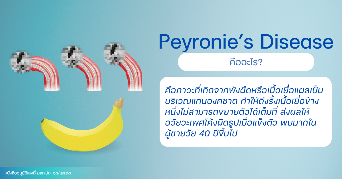 Peyronie’s Disease - eternityclinicdoctorbeer Peyronie’s Disease