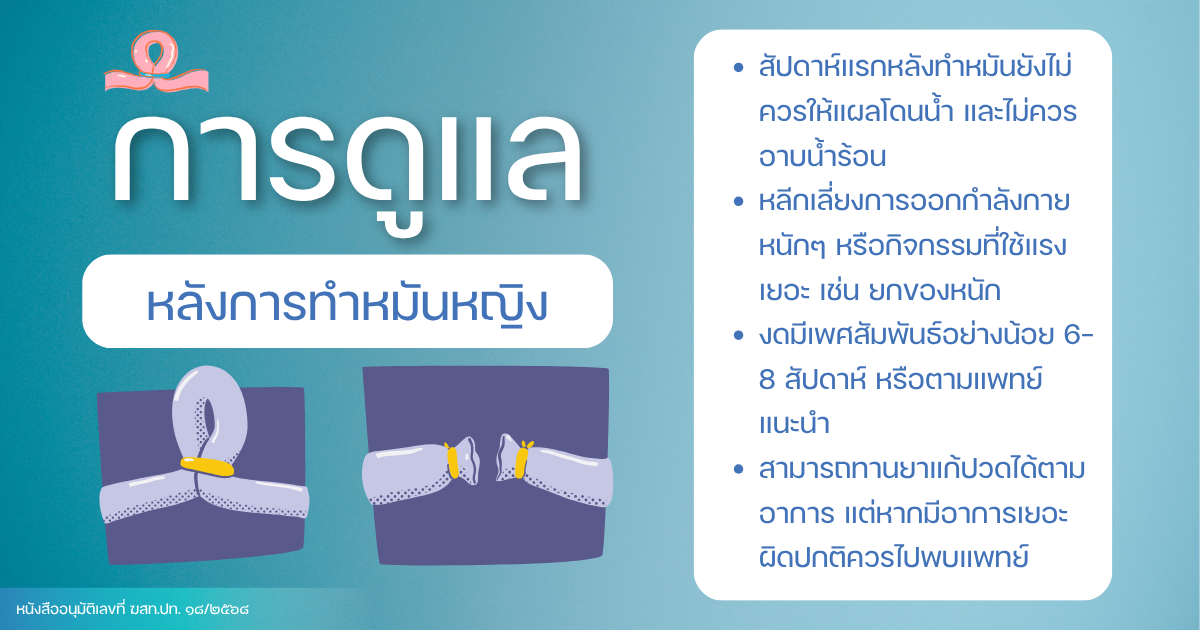 การดูแลหลังการทำหมันหญิง