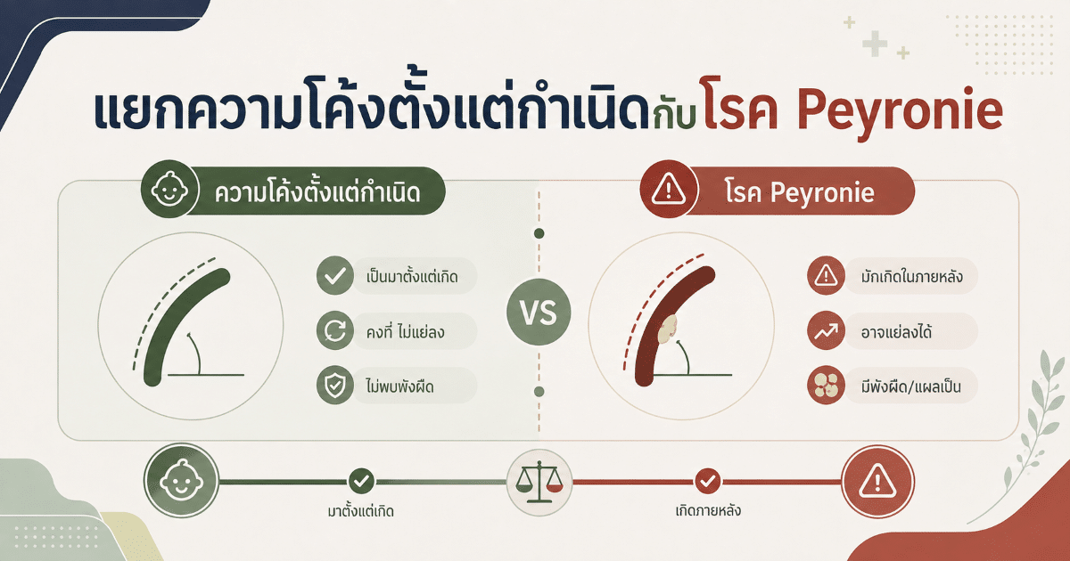แยกความโค้งตั้งแต่กำเนิดกับโรค Peyronie