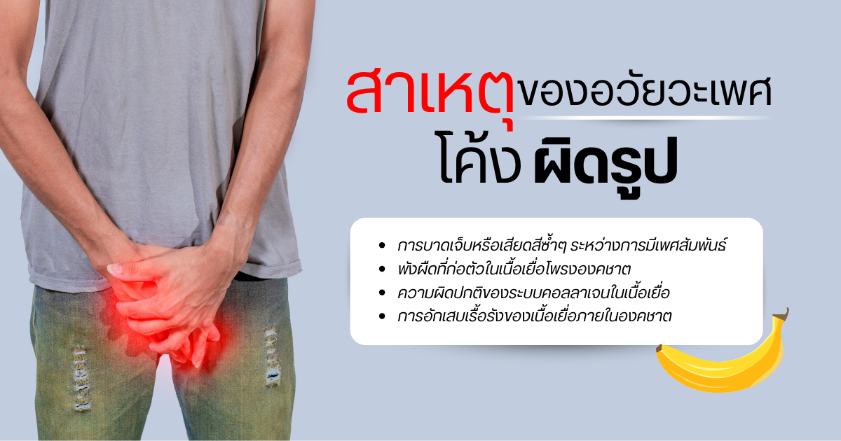 สาเหตุของอวัยวะเพศโค้ง
