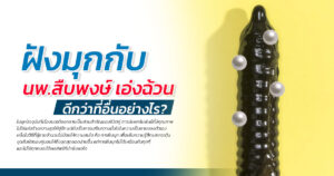 การฝังมุก