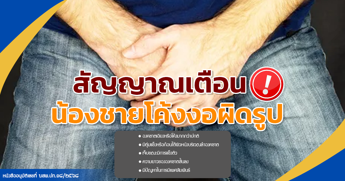 น้องชายโค้งงอ