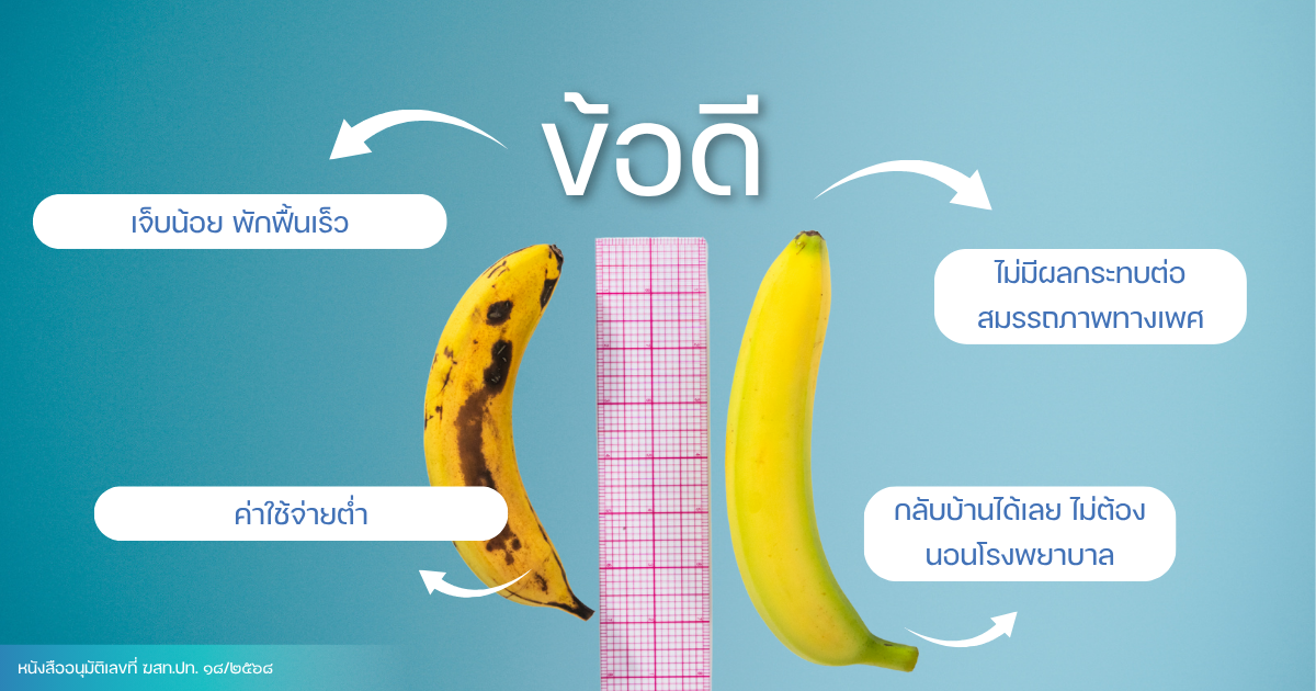 การทำหมันชาย คืออะไร?