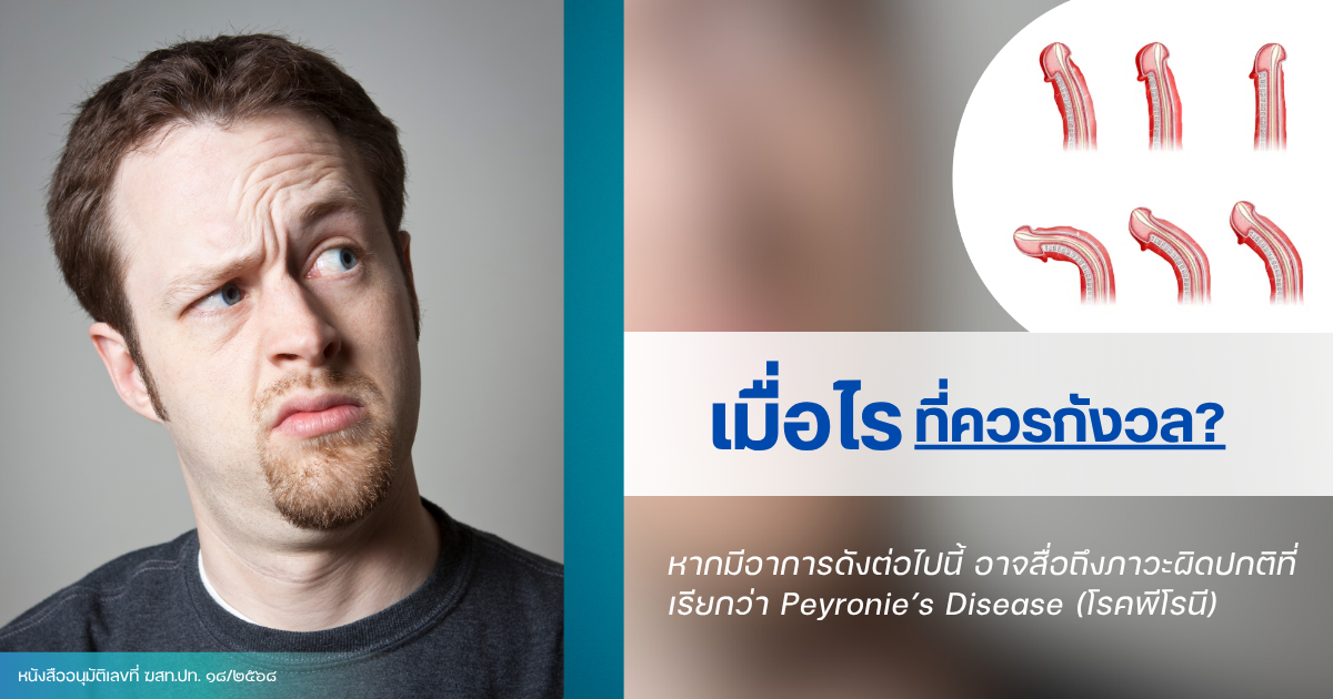 worry - eternityclinicdoctorbeer โรคพีโรนี