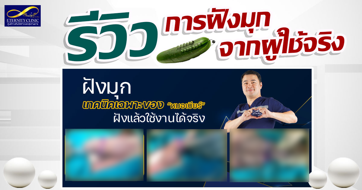 เบลอรูปภาพ2 - eternityclinicdoctorbeer