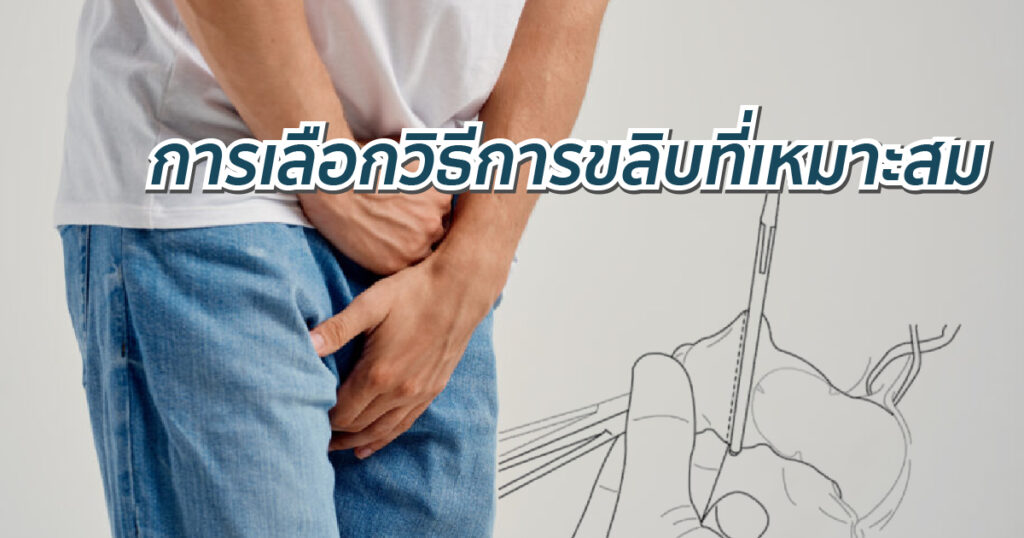 การเลือกวิธีการขลิบที่เหมาะสม - eternityclinicdoctorbeer