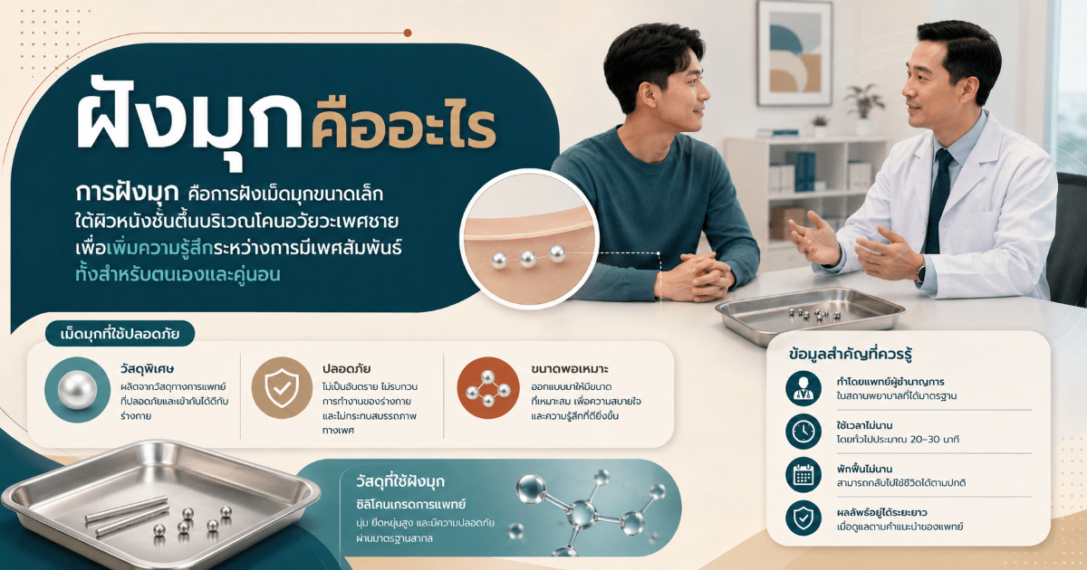 ฝังมุกคืออะไร