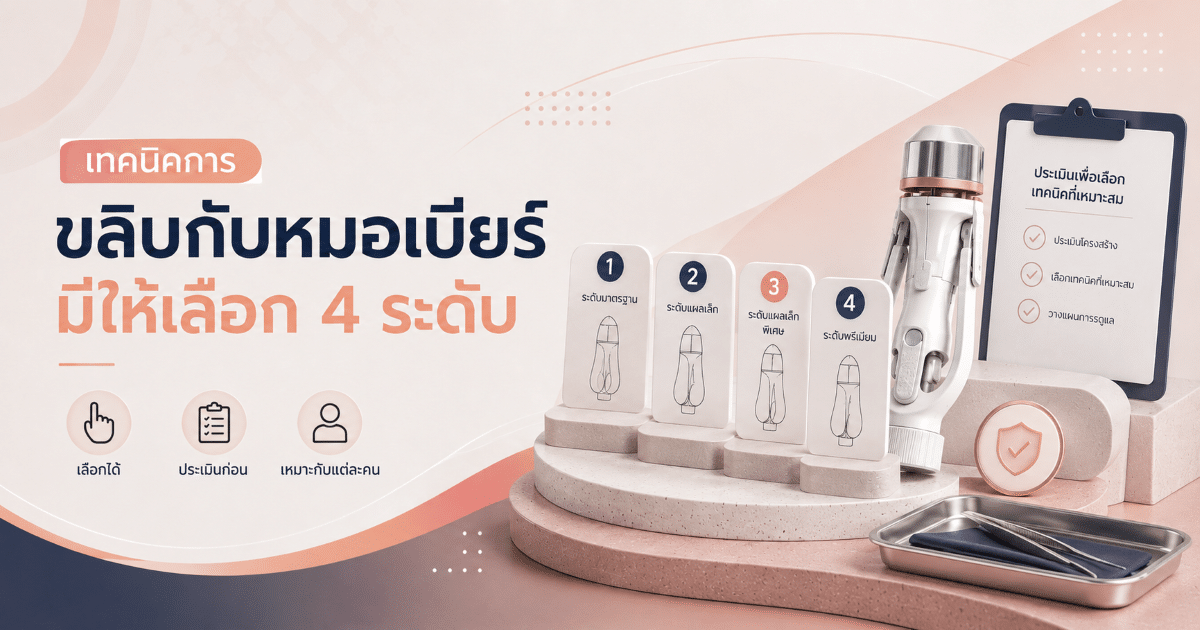 เทคนิคการขลิบกับหมอเบียร์มีให้เลือก 4 ระดับ