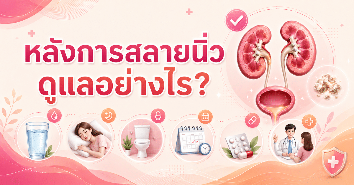 หลังการสลายนิ่ว ดูแลอย่างไร?
