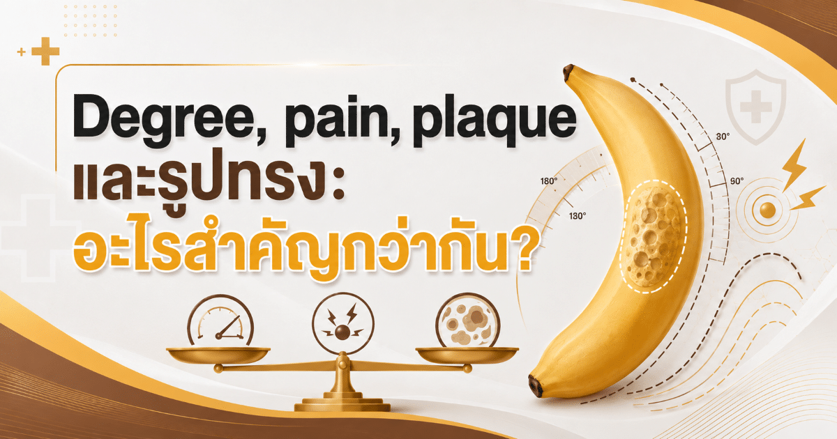 Degree, pain, plaque และรูปทรง: อะไรสำคัญกว่ากัน?