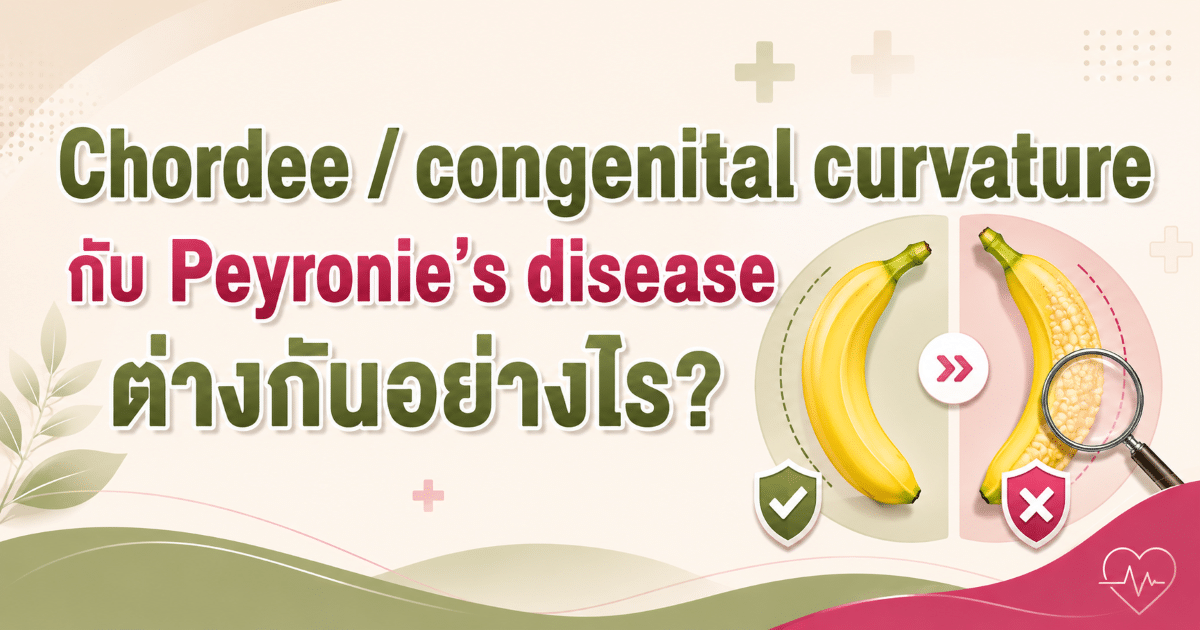 Chordee / congenital curvature กับ Peyronie’s disease ต่างกันอย่างไร?