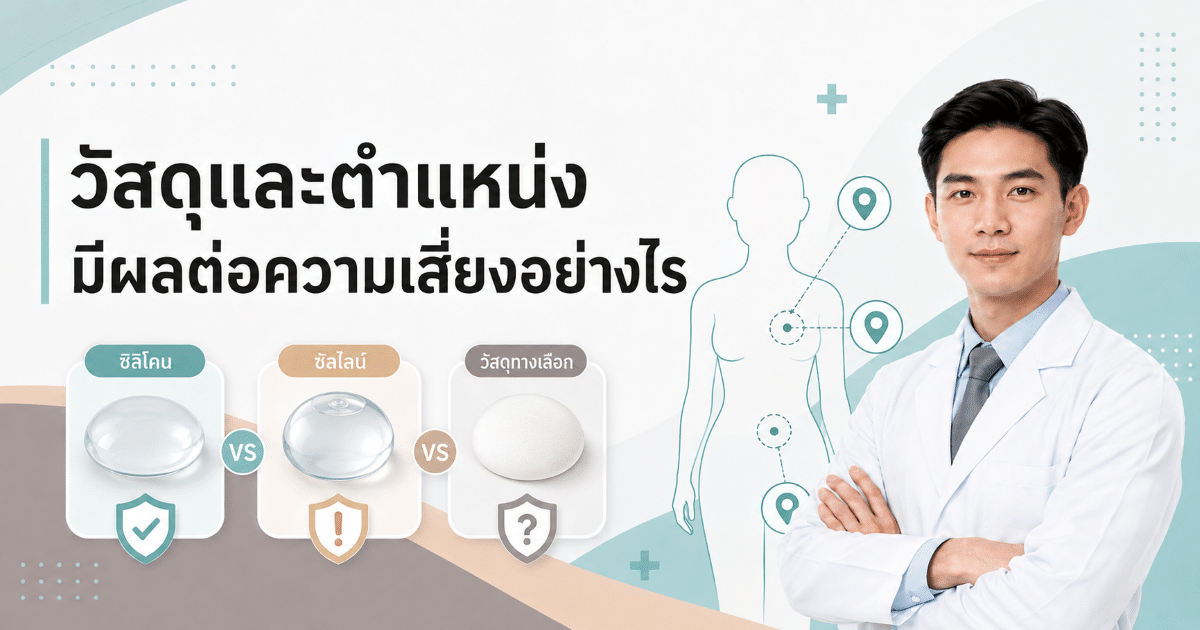 วัสดุและตำแหน่งมีผลต่อความเสี่ยงอย่างไร