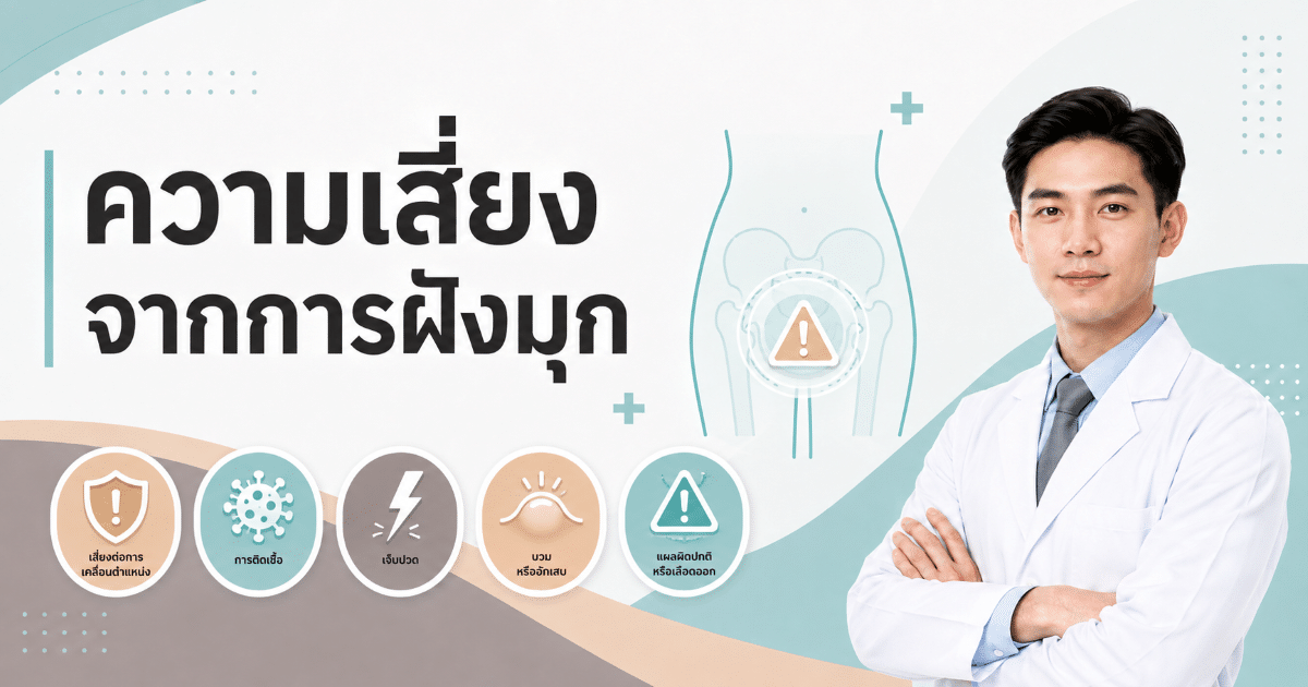 ความเสี่ยงจากการฝังมุก