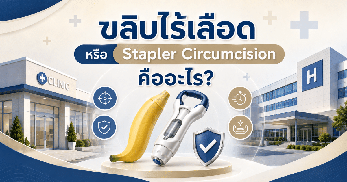 ขลิบไร้เลือด หรือ Stapler Circumcision คืออะไร?