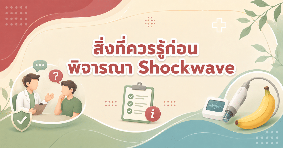สิ่งที่ควรรู้ก่อนพิจารณา Shockwave