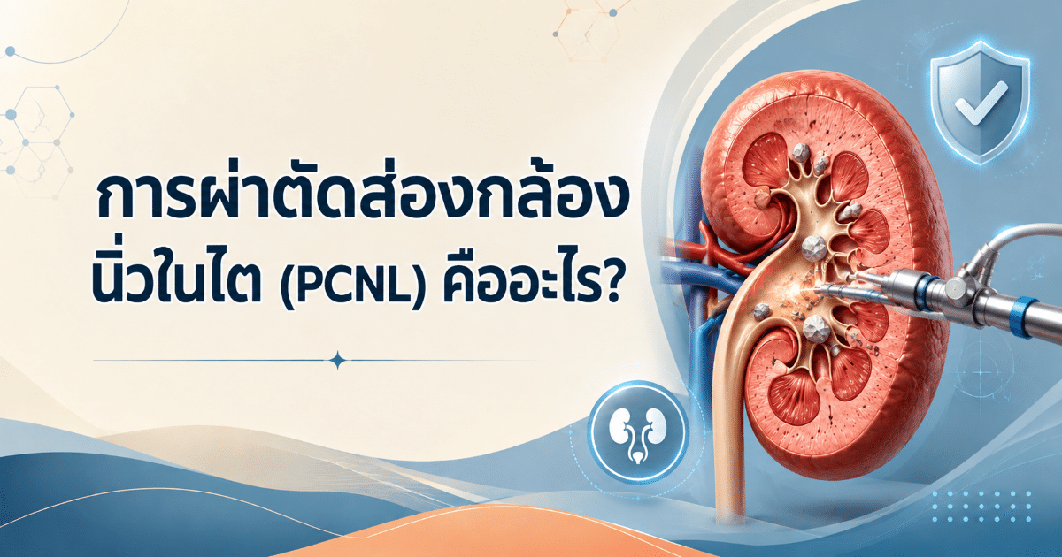 การผ่าตัดส่องกล้องนิ่วในไต (PCNL) คืออะไร?