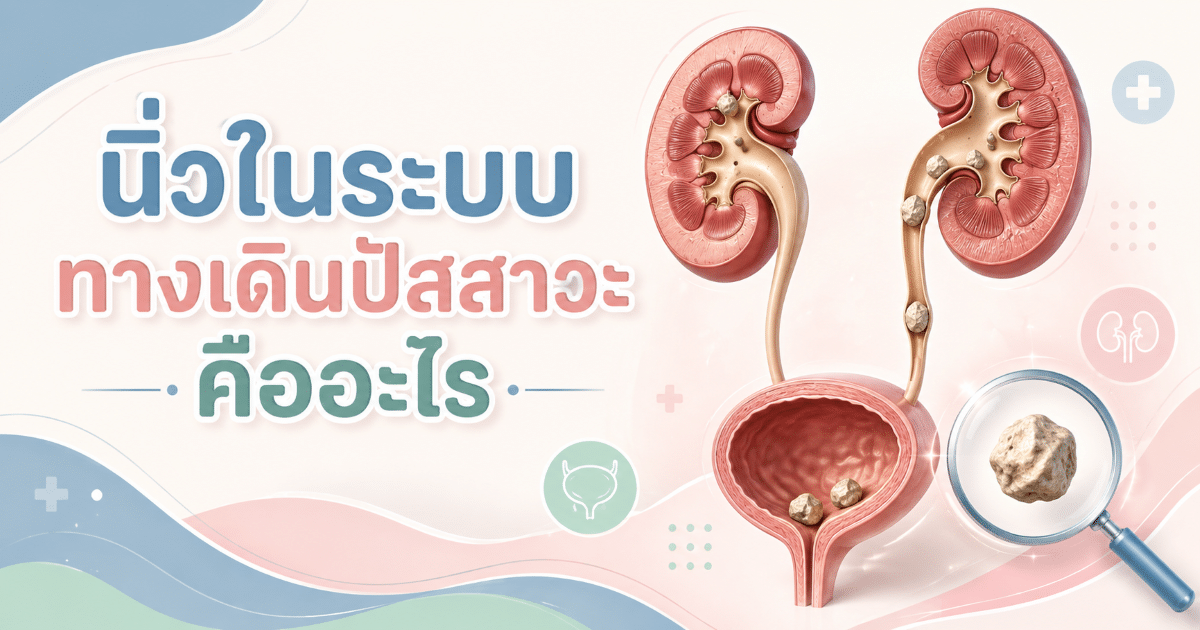 นิ่วในระบบทางเดินปัสสาวะ คืออะไร