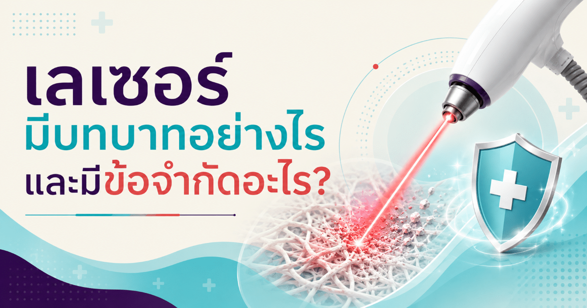 เลเซอร์มีบทบาทอย่างไร และมีข้อจำกัดอะไร?
