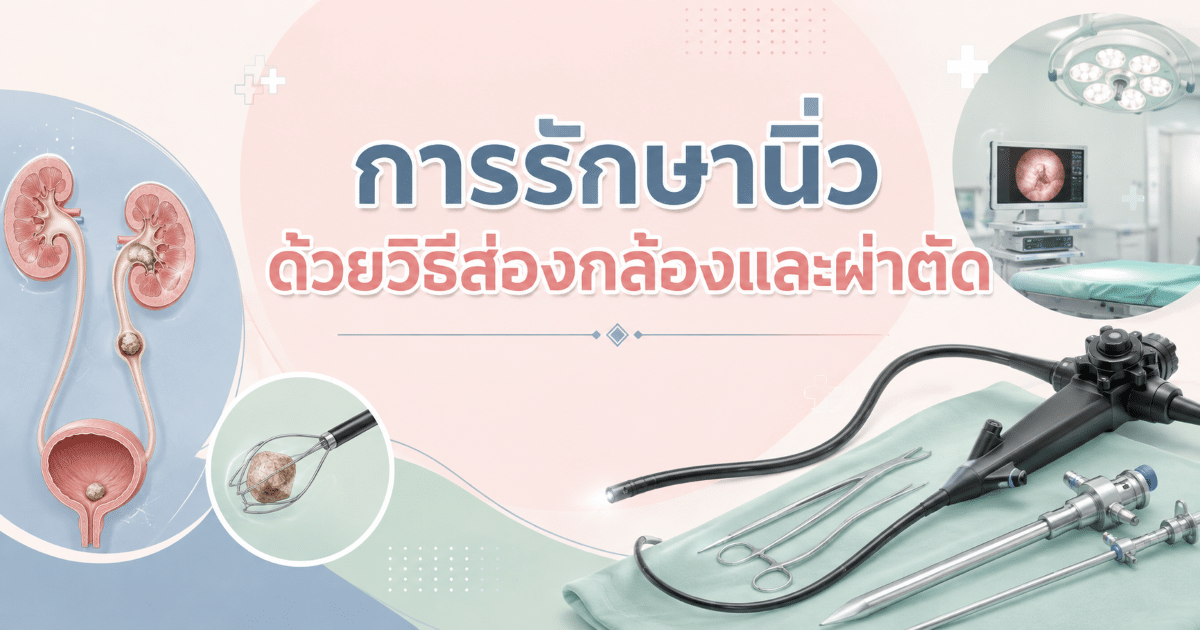 การรักษานิ่วด้วยวิธีส่องกล้องและผ่าตัด
