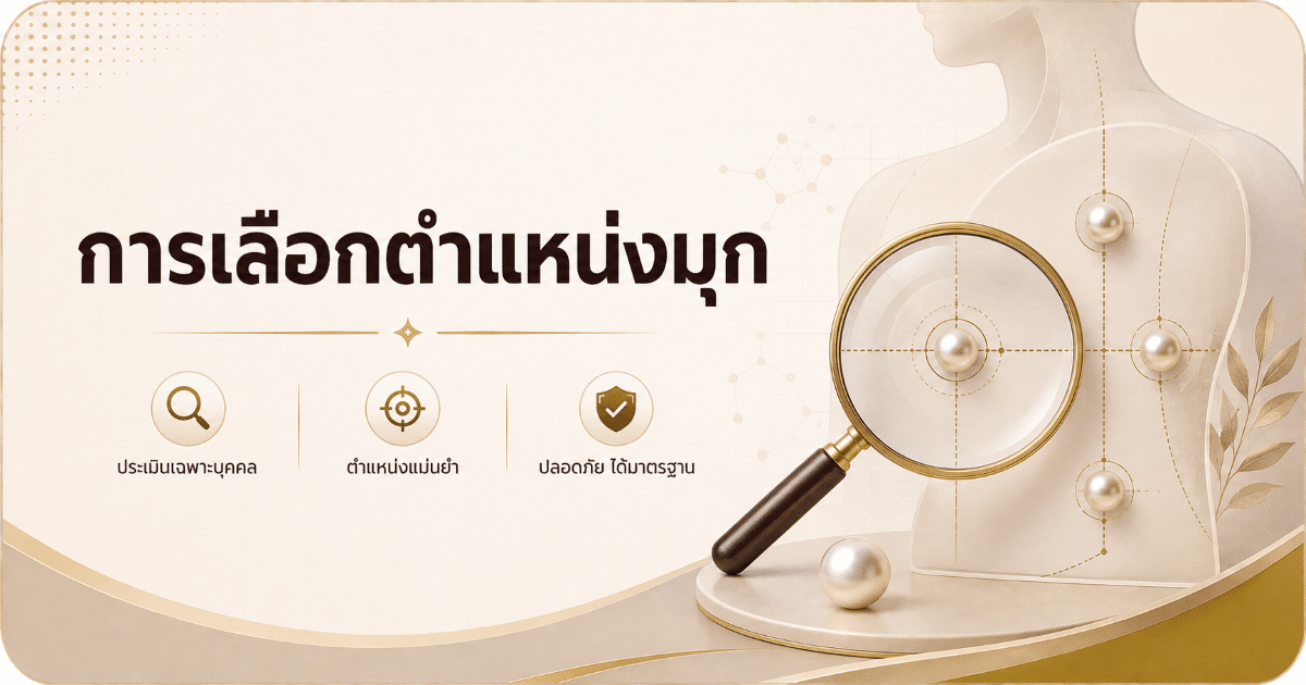 การเลือกตำแหน่งมุก