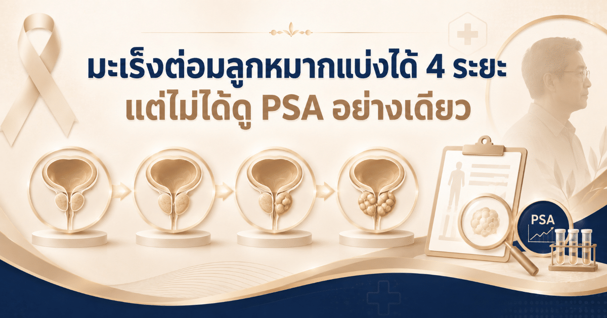 มะเร็งต่อมลูกหมากแบ่งได้ 4 ระยะ แต่ไม่ได้ดู PSA อย่างเดียว