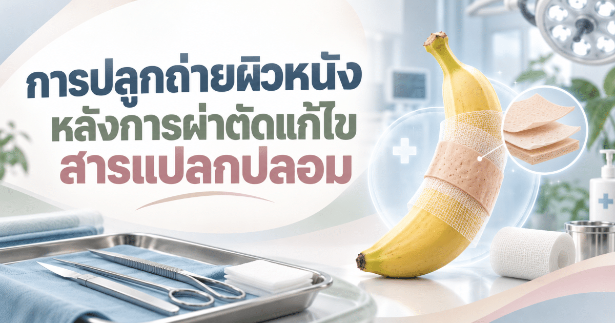 การปลูกถ่ายผิวหนังหลังการผ่าตัดแก้ไขสารแปลกปลอม